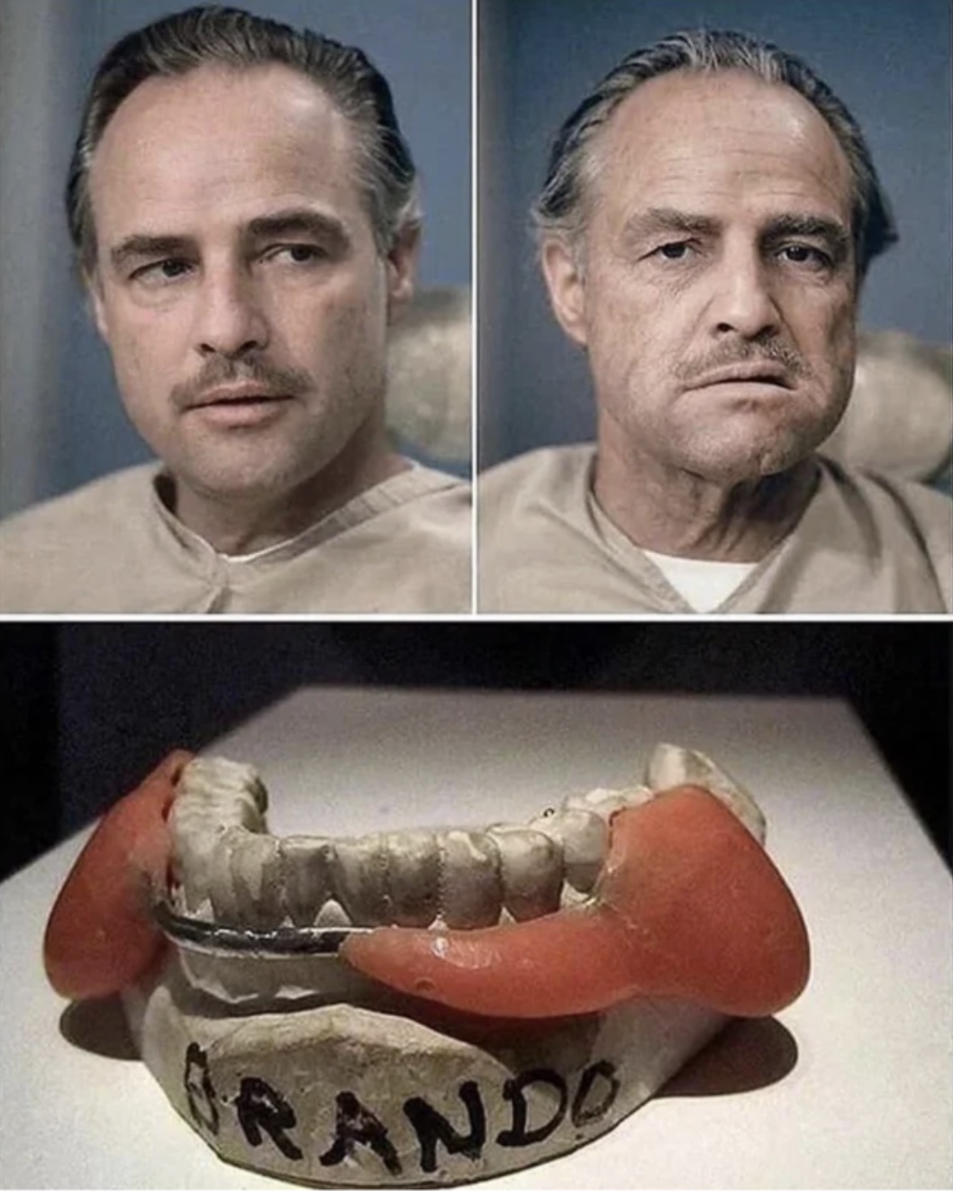 Brando's prosthetic teeth for Vito